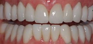 After Cosmetic