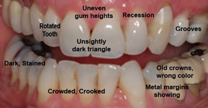 Before Cosmetic